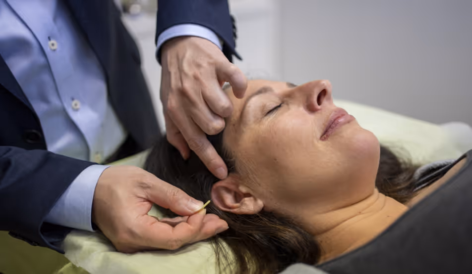 Acupuncture
